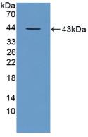 Polyclonal Antibody to Tripeptidyl Peptidase I (TPP1)