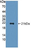 Polyclonal Antibody to Adenylyl Cyclase Associated Protein 2 (CAP2)