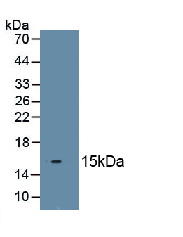 Polyclonal Antibody to Twist Transcription Factor (TWIST)