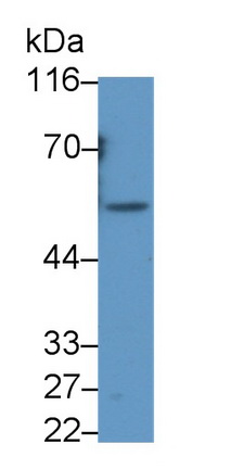 Polyclonal Antibody to Src Kinase Associated Phosphoprotein 1 (SKAP1)