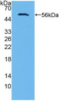 Polyclonal Antibody to Aminoadipate Semialdehyde Synthase (AASS)