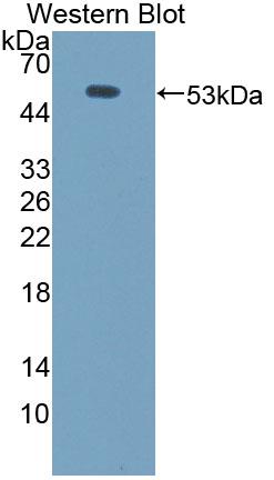 Polyclonal Antibody to Aminoadipate Semialdehyde Synthase (AASS)