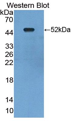 Polyclonal Antibody to Synuclein Alpha Interacting Protein 1 (SNCaIP1)