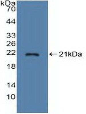 Polyclonal Antibody to Stathmin 1 (STMN1)