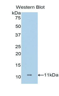 Polyclonal Antibody to Dermcidin (DCD)