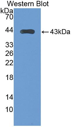 Polyclonal Antibody to Glutamate Decarboxylase 1, Brain (GAD1)