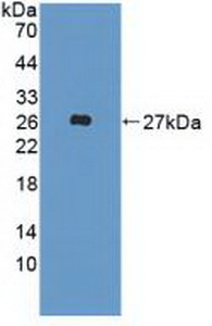 Polyclonal Antibody to Fibroblast Growth Factor 19 (FGF19)