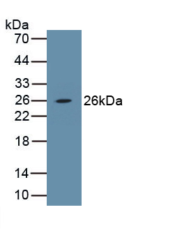 Polyclonal Antibody to Platelet Derived Growth Factor Subunit B (PDGFB)