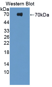 Polyclonal Antibody to Platelet Derived Growth Factor Receptor Like Protein (PDGFRL)