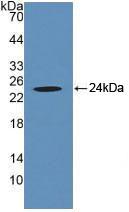 Polyclonal Antibody to Crystallin Alpha B (CRYaB)