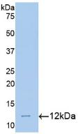 Polyclonal Antibody to Melatonin Receptor 1A (MTNR1A)