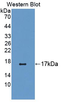 Polyclonal Antibody to Cannabinoid Receptor 1, Brain (CNR1)