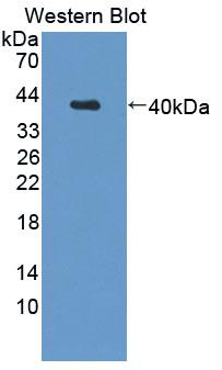 Polyclonal Antibody to Calpain 5 (CAPN5)