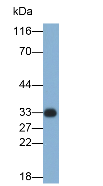 Polyclonal Antibody to Cathepsin B (CTSB)