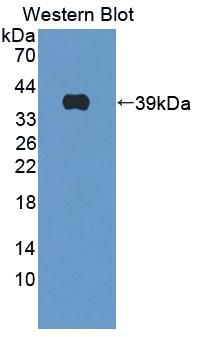 Polyclonal Antibody to Cathepsin H (CTSH)