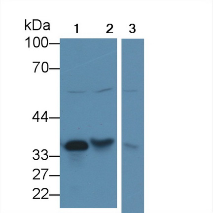 Polyclonal Antibody to Cathepsin Z (CTSZ)