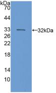 Polyclonal Antibody to Complement Component 6 (C6)