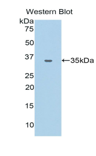 Polyclonal Antibody to Carcinoembryonic Antigen Related Cell Adhesion Molecule 1 (CEACAM1)