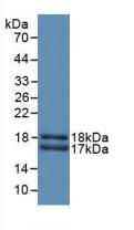 Polyclonal Antibody to Carcinoembryonic Antigen Related Cell Adhesion Molecule 1 (CEACAM1)