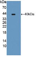 Polyclonal Antibody to Poly ADP Ribose Polymerase 4 (PARP4)