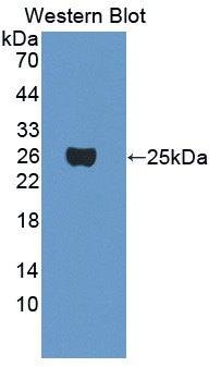 Polyclonal Antibody to Crystallin Gamma F (CRYgF)