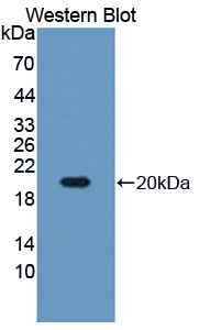 Polyclonal Antibody to Arginyl tRNA Synthetase (RARS)