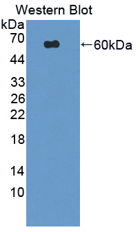 Polyclonal Antibody to Isoleucyl tRNA Synthetase (IARS)