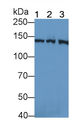 Polyclonal Antibody to Valyl tRNA Synthetase (VARS)