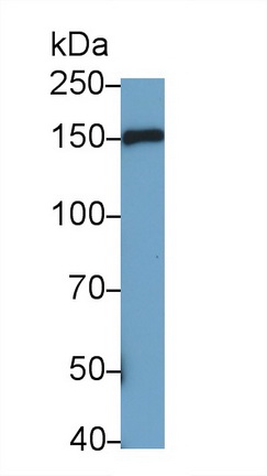 Polyclonal Antibody to Myosin Binding Protein C, Cardiac (MYBPC3)