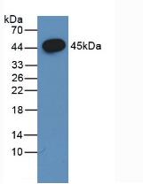 Polyclonal Antibody to Follicle Stimulating Hormone Beta (FSHb)