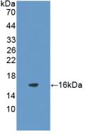 Polyclonal Antibody to Follicle Stimulating Hormone Beta (FSHb)