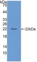 Polyclonal Antibody to Ferritin, Light Polypeptide (FTL)