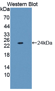 Polyclonal Antibody to Ferritin, Light Polypeptide (FTL)