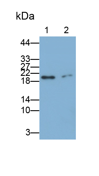 Polyclonal Antibody to Ferritin, Heavy Polypeptide (FTH)