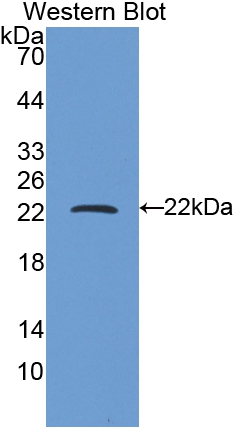 Polyclonal Antibody to Ferritin, Heavy Polypeptide (FTH)