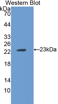 Polyclonal Antibody to Ferritin, Heavy Polypeptide (FTH)