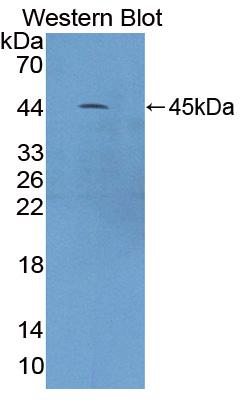 Polyclonal Antibody to Calcium/Calmodulin Dependent Protein Kinase I (CAMK1)