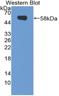 Polyclonal Antibody to Neuropilin 2 (NRP2)