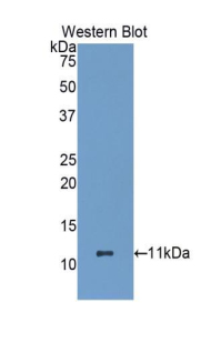 Polyclonal Antibody to Heat Shock 70kDa Protein 8 (HSPA8)