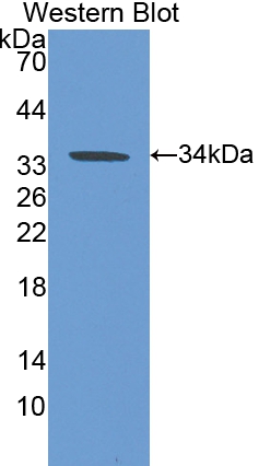 Polyclonal Antibody to Carbonic Anhydrase VB, Mitochondrial (CA5B)