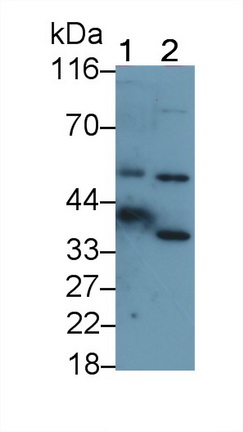 Polyclonal Antibody to Carbonic Anhydrase VI (CA6)