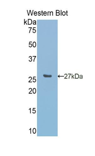 Polyclonal Antibody to Carbonic Anhydrase VA (CA5A)