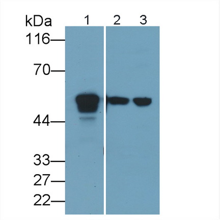 Polyclonal Antibody to Acid Phosphatase 2, Lysosomal (ACP2)