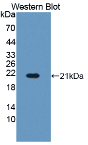 Polyclonal Antibody to Hemoglobin Beta (HBb)