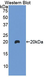 Polyclonal Antibody to Hemoglobin Beta (HBb)