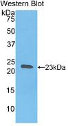 Polyclonal Antibody to Hemoglobin Beta (HBb)