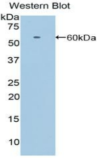 Polyclonal Antibody to Low Density Lipoprotein Receptor Related Protein 8 (LRP8)