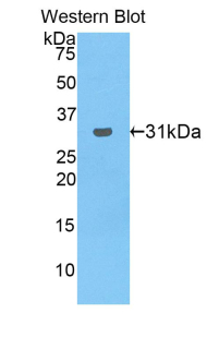 Polyclonal Antibody to Low Density Lipoprotein Receptor Related Protein Associated Protein 1 (LRPAP1)