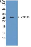 Polyclonal Antibody to Low Density Lipoprotein Receptor Related Protein 1B (LRP1B)