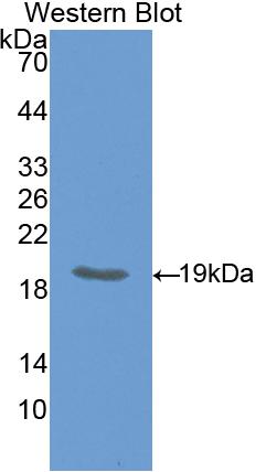 Polyclonal Antibody to Hedgehog Homolog, Indian (IHH)